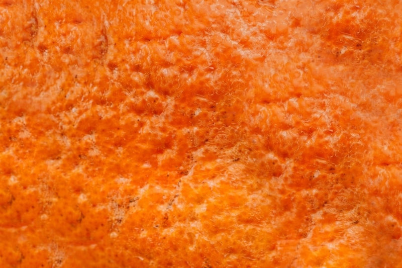 Anti-Cellulite