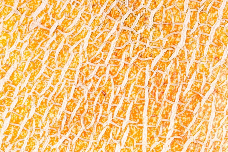 Stretch Marks